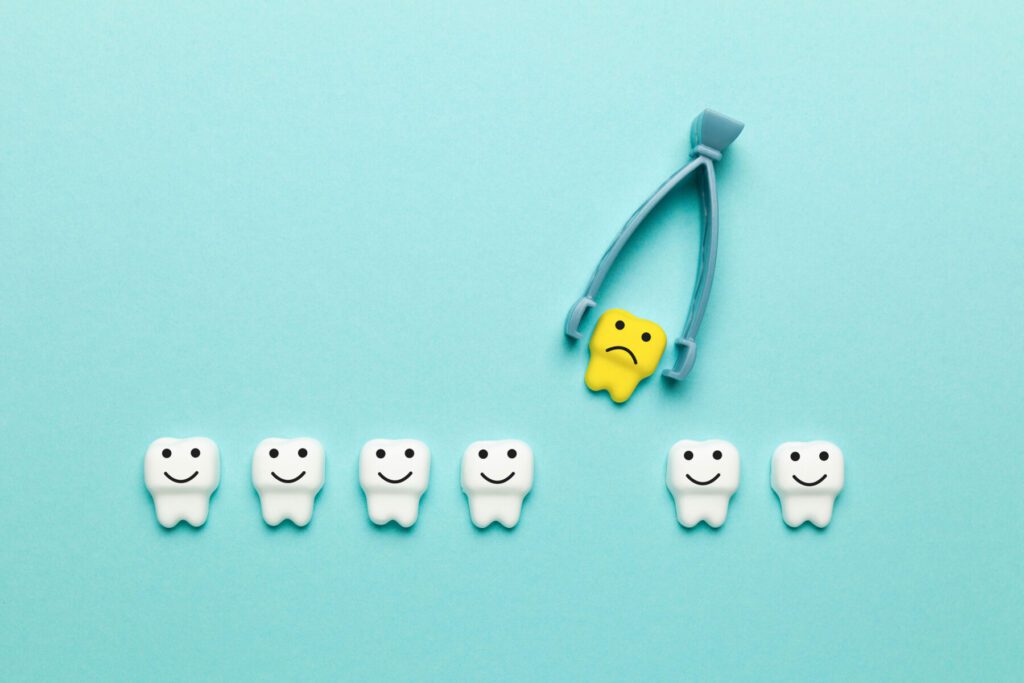 wisdom tooth extraction