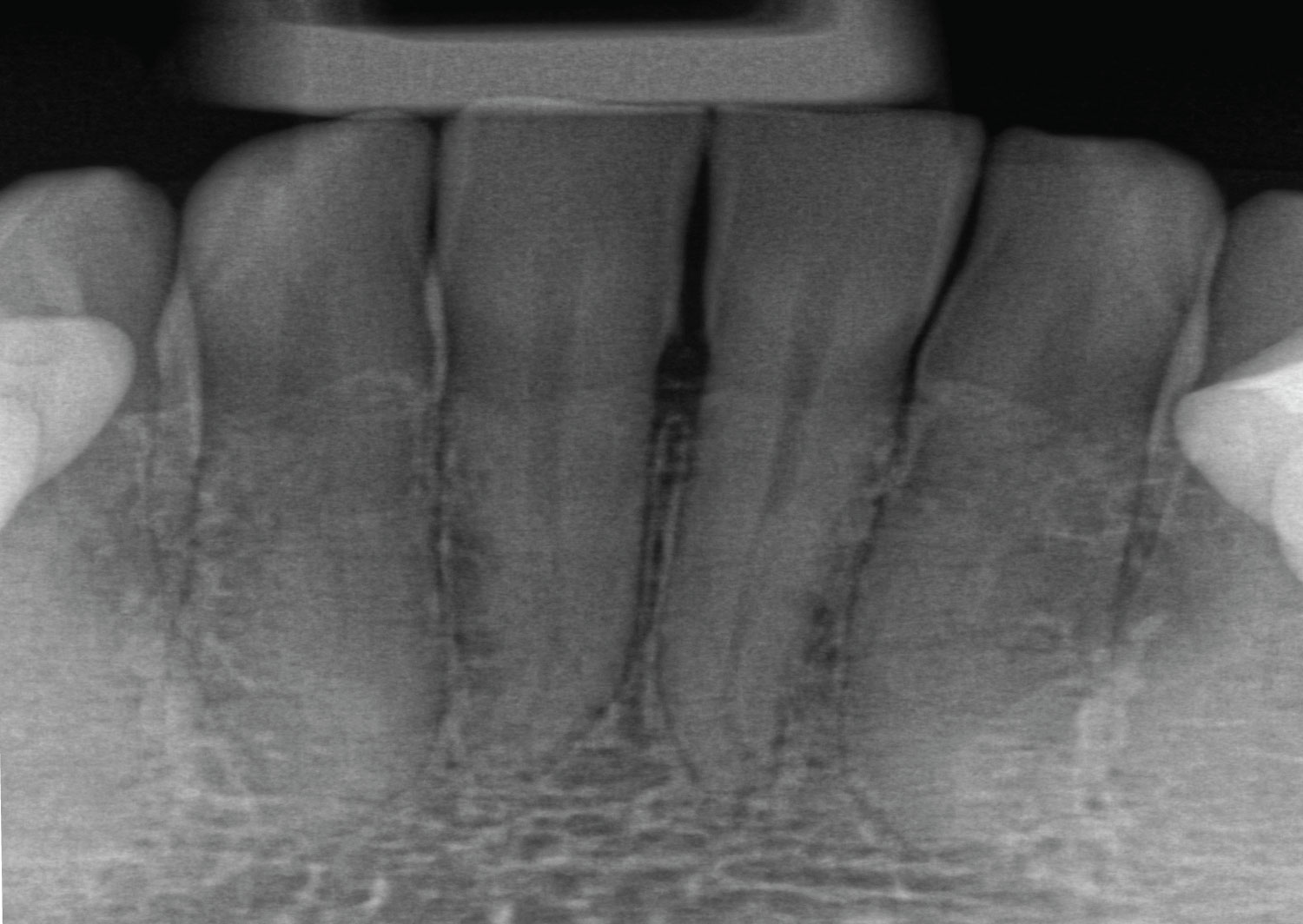 Dental XRays at Our Calgary Dentist Office Advance Your Health