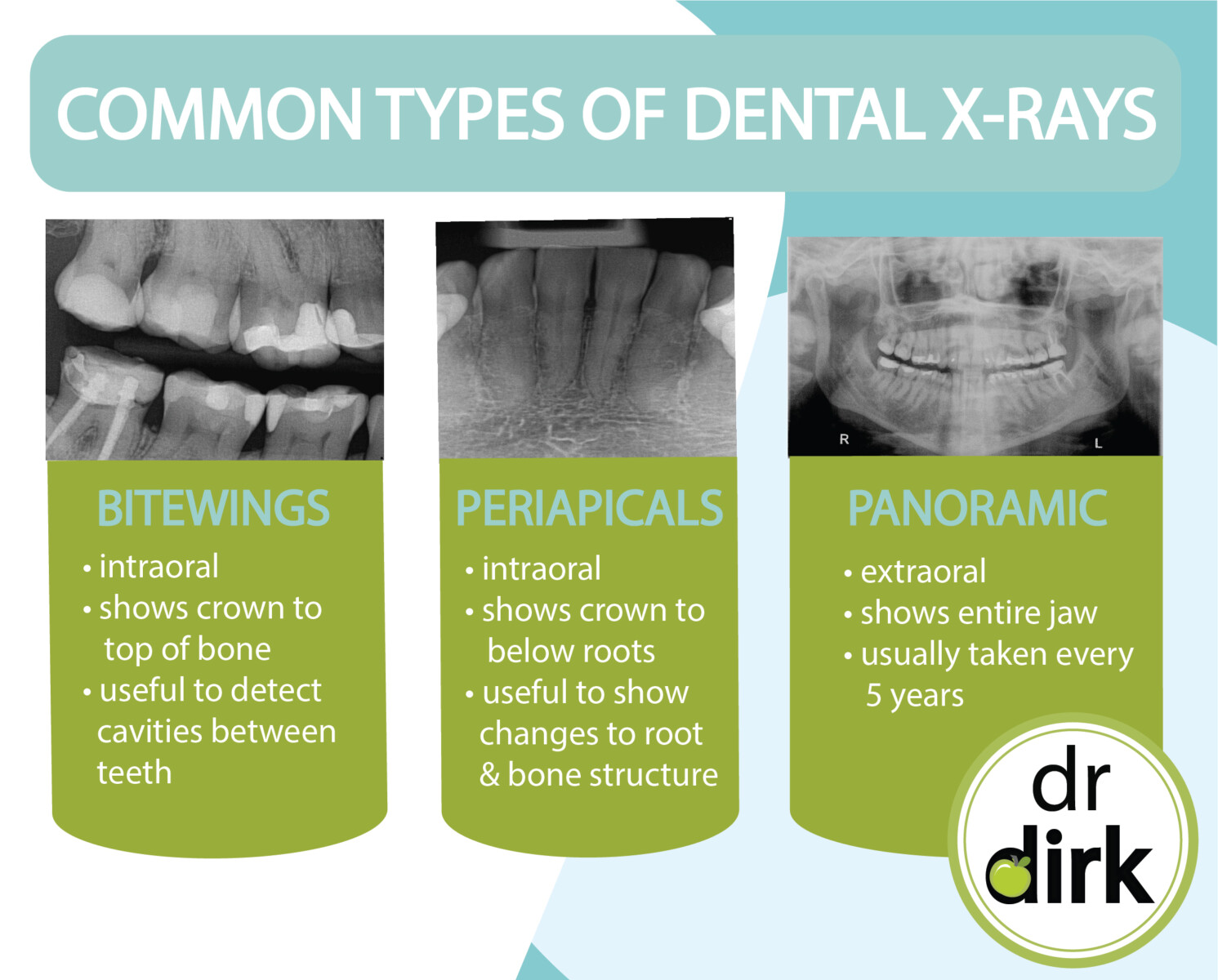 Types of Dental XRays At Our Calgary Dentist Office Advance Your
